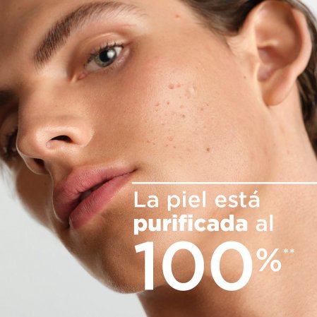 Resultados inmediatos Resultados inmediatos