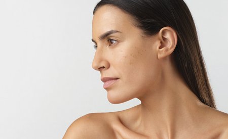 Piel femenina con producto bioderma