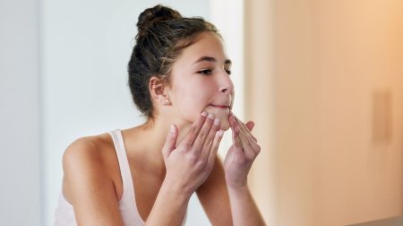 Teenager examining chin acne, highlighting Sébium serum use.