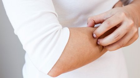 Mujer rascandose el braso 