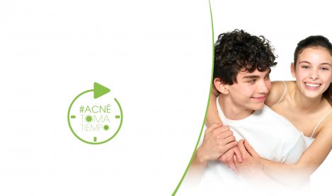 Acne-toma-tiempo