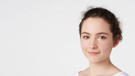 BIODERMA - piel con acné en adolescentes