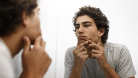 your-skin_sebium-sensitive_FIRST-ACNE-CONSULTATION